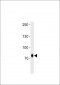 ZNF219 Antibody (C-term)
